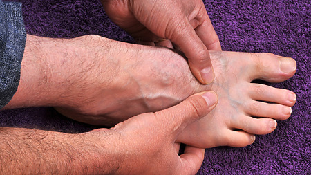 Ankle pain