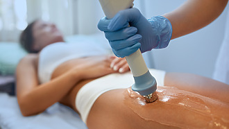 Shock wave cellulite