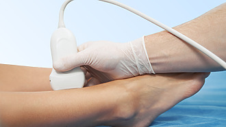 Doppler test - examination of varicose ulcers