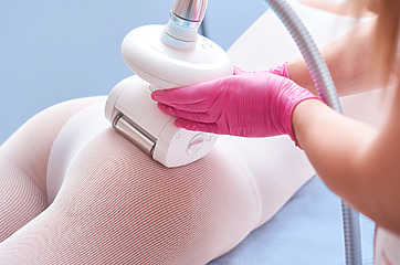 LPG procedure